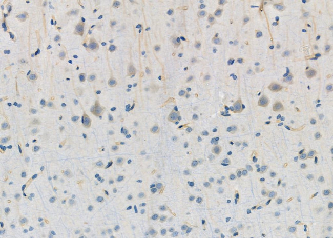 GSS Antibody in Immunohistochemistry (Paraffin) (IHC (P))