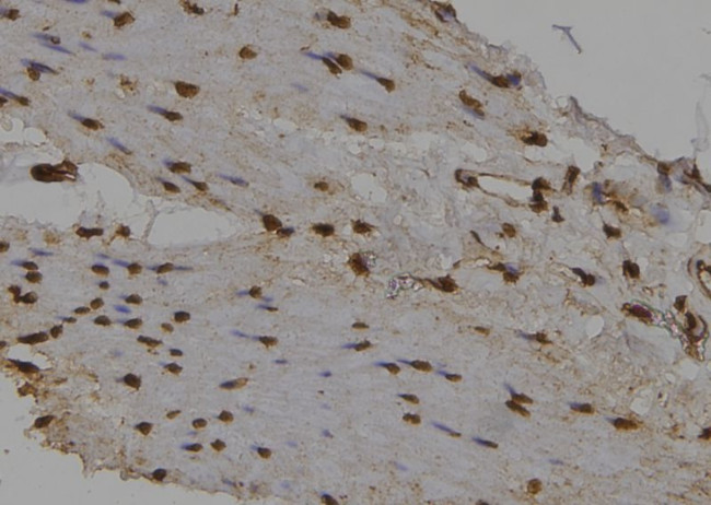 NUAK2 Antibody in Immunohistochemistry (Paraffin) (IHC (P))