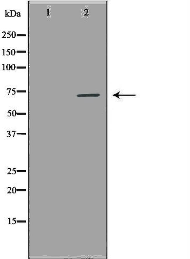 NUAK2 Antibody in Western Blot (WB)