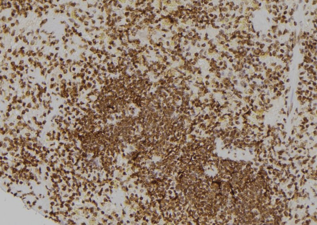 CDC25A Antibody in Immunohistochemistry (Paraffin) (IHC (P))