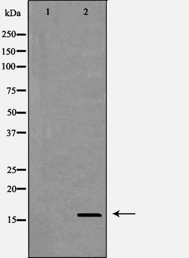 Cystatin 8 Antibody in Western Blot (WB)