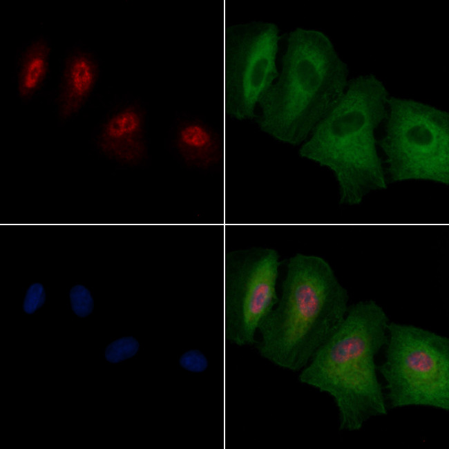 PXR Antibody in Immunocytochemistry (ICC/IF)