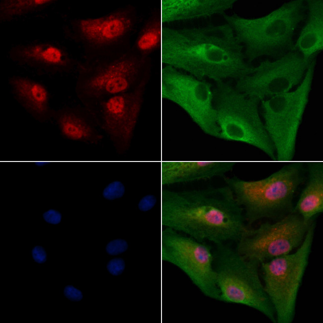 SRSF1 Antibody in Immunocytochemistry (ICC/IF)