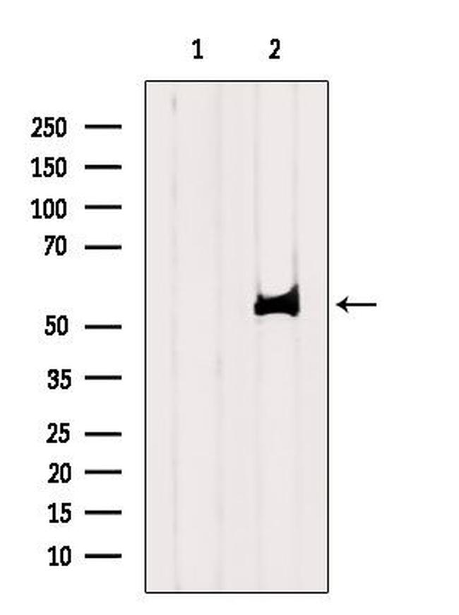 SLC22A5 Antibody in Western Blot (WB)