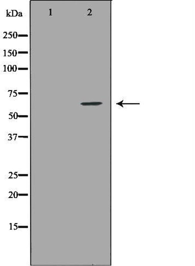 IL10RA Antibody in Western Blot (WB)