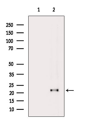 GPX4 Antibody in Western Blot (WB)