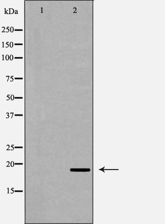 REG3A Antibody in Western Blot (WB)