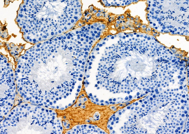 ELSPBP1 Antibody in Immunohistochemistry (Paraffin) (IHC (P))