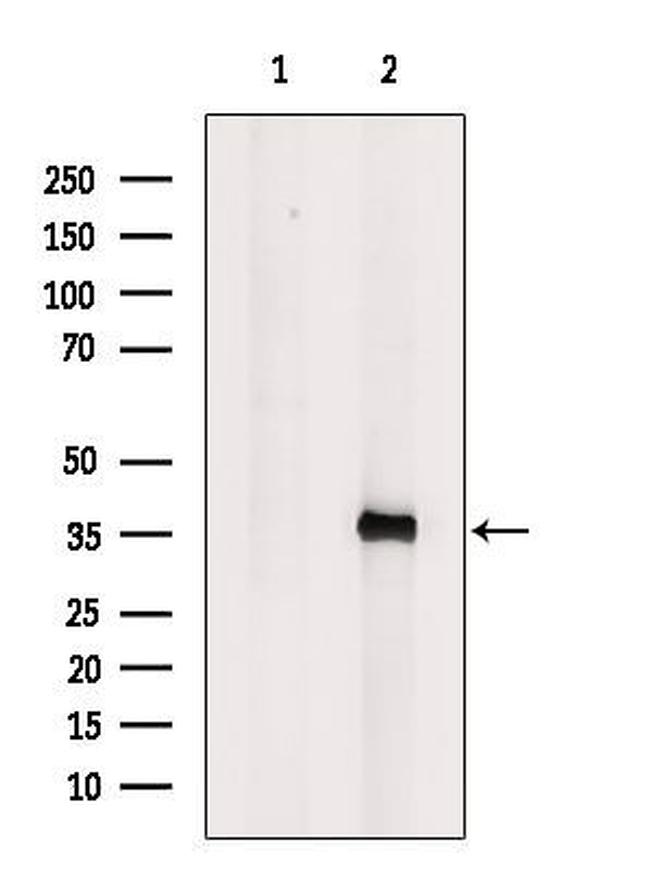 ELSPBP1 Antibody in Western Blot (WB)