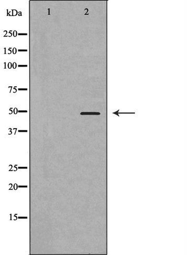 D4 Dopamine Receptor Antibody in Western Blot (WB)