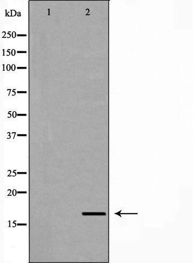 Myoglobin Antibody in Western Blot (WB)