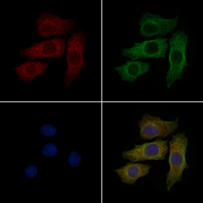 S100A11 Antibody in Immunocytochemistry (ICC/IF)