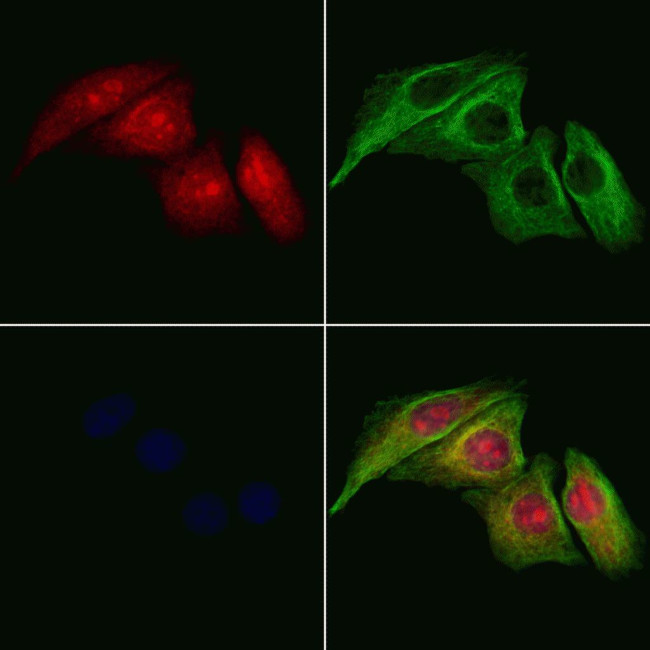 UBD Antibody in Immunocytochemistry (ICC/IF)