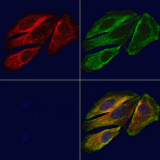 UGT1A4 Antibody in Immunocytochemistry (ICC/IF)