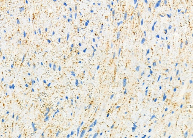 UGT1A4 Antibody in Immunohistochemistry (Paraffin) (IHC (P))