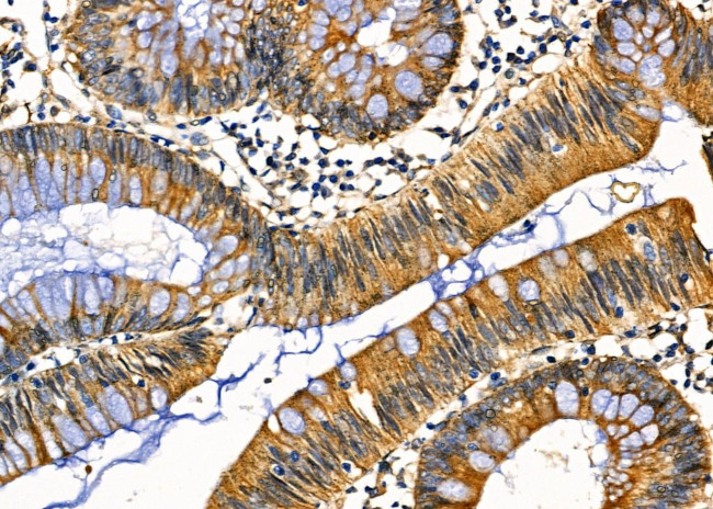 PGRMC1 Antibody in Immunohistochemistry (Paraffin) (IHC (P))