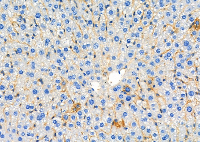 UGT2B17 Antibody in Immunohistochemistry (Paraffin) (IHC (P))