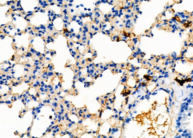 UGT2B17 Antibody in Immunohistochemistry (Paraffin) (IHC (P))