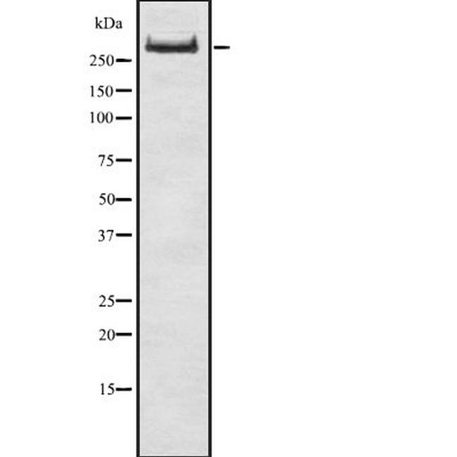 Thyroglobulin Antibody in Western Blot (WB)