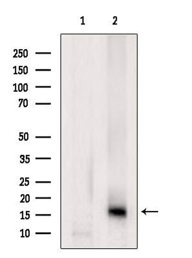 Lysozyme Antibody in Western Blot (WB)