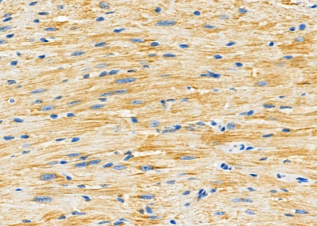 GluR4 Antibody in Immunohistochemistry (Paraffin) (IHC (P))