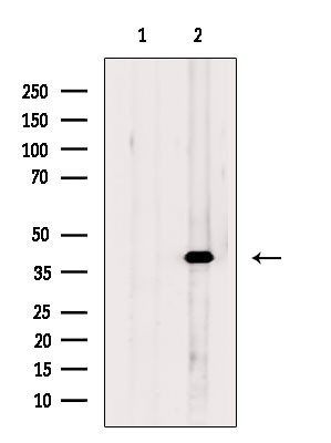 CAB39 Antibody in Western Blot (WB)