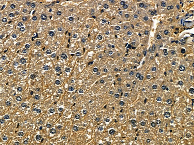 GRB7 Antibody in Immunohistochemistry (Paraffin) (IHC (P))