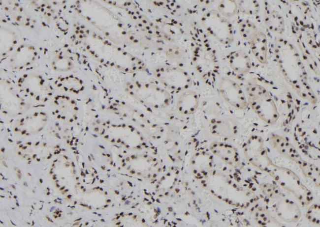 HDLBP Antibody in Immunohistochemistry (Paraffin) (IHC (P))