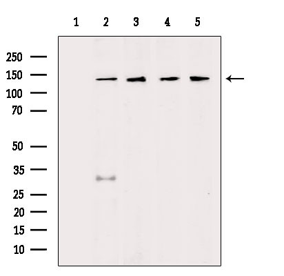 HDLBP Antibody in Western Blot (WB)