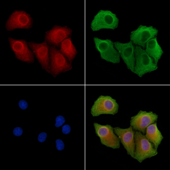 OS9 Antibody in Immunocytochemistry (ICC/IF)