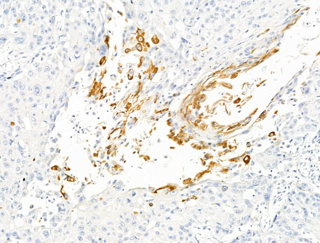 HSPA6 Antibody in Immunohistochemistry (Paraffin) (IHC (P))