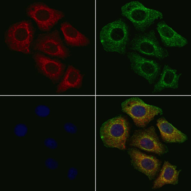 CTPS Antibody in Immunocytochemistry (ICC/IF)