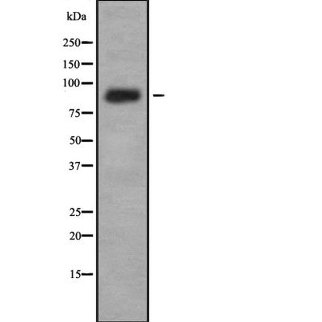 IL4R Antibody in Western Blot (WB)