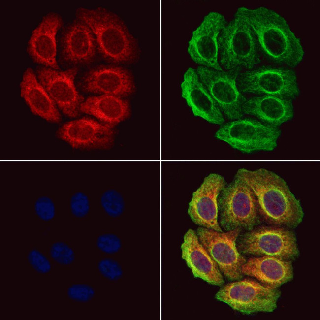 Pepsin A Antibody in Immunocytochemistry (ICC/IF)