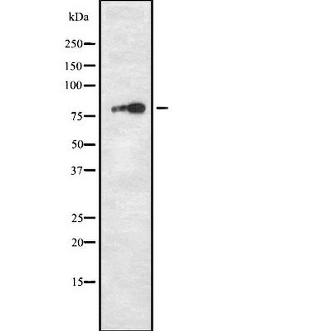 TPX2 Antibody in Western Blot (WB)