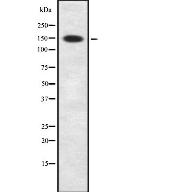 NBEAL1 Antibody in Western Blot (WB)