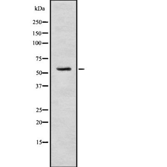 SRPK3 Antibody in Western Blot (WB)