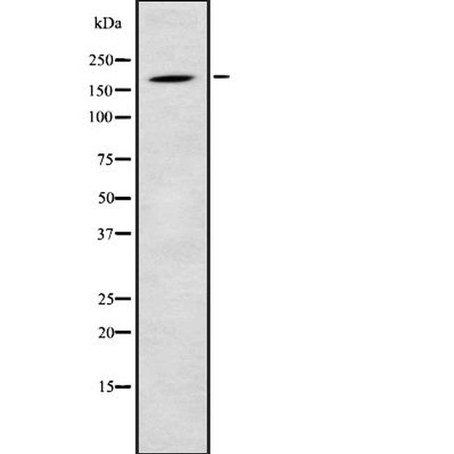 LMO7 Antibody in Western Blot (WB)