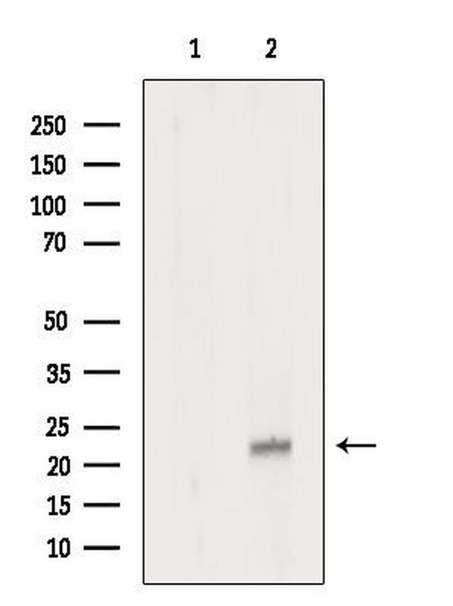 APOBEC3C Antibody in Western Blot (WB)