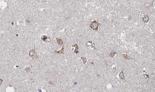 HTR2A Antibody in Immunohistochemistry (Paraffin) (IHC (P))