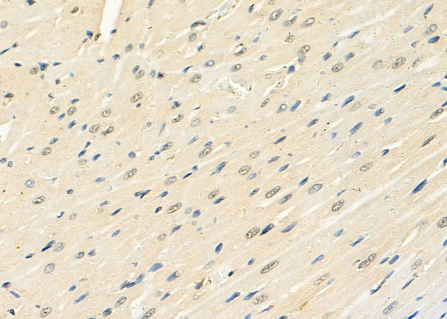 CIDEC Antibody in Immunohistochemistry (Paraffin) (IHC (P))