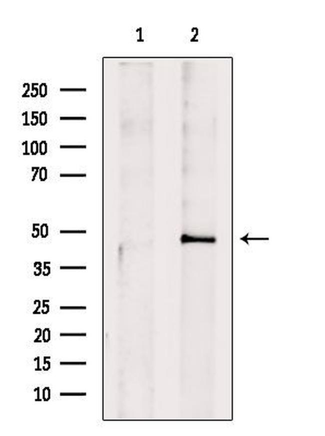 IL10RB Antibody in Western Blot (WB)