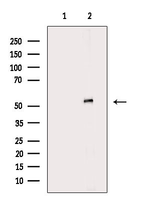 KRT83 Antibody in Western Blot (WB)