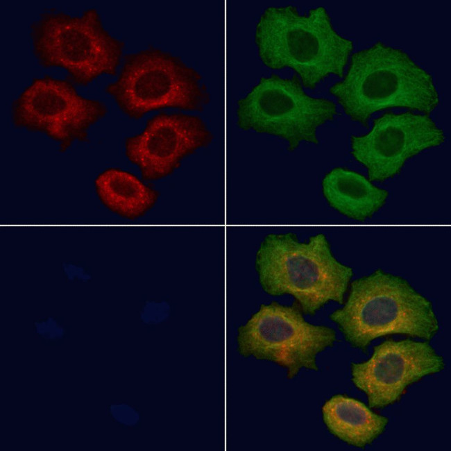 Cyclin B2 Antibody in Immunocytochemistry (ICC/IF)