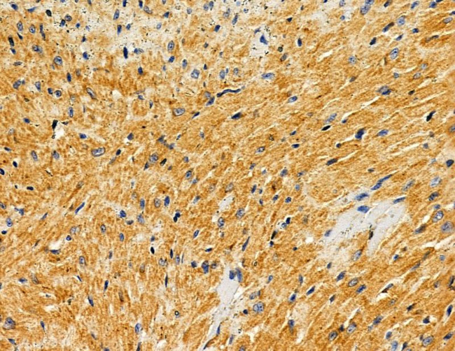 HUS1B Antibody in Immunohistochemistry (Paraffin) (IHC (P))