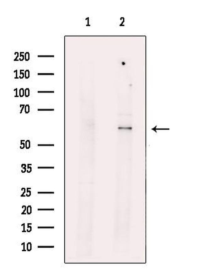 LPCAT4 Antibody in Western Blot (WB)