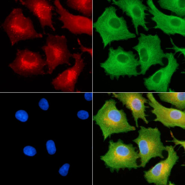 PSMD9 Antibody in Immunocytochemistry (ICC/IF)