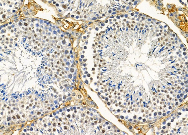 PSMD9 Antibody in Immunohistochemistry (Paraffin) (IHC (P))