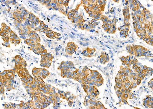 RPS4Y1/RPS4Y2 Antibody in Immunohistochemistry (Paraffin) (IHC (P))