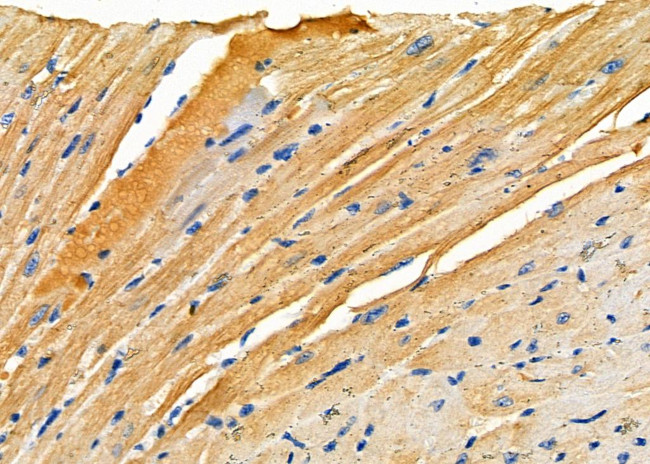 RPS4Y1/RPS4Y2 Antibody in Immunohistochemistry (Paraffin) (IHC (P))